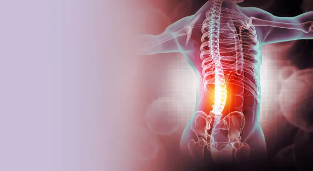 Estudio radiológico donde se observan signos de lumbalgia en la zona lumbar, reflejando el desgaste en los discos intervertebrales.