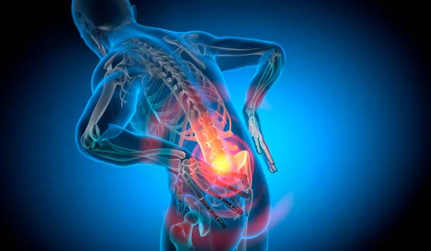 Imagen médica de un paciente con lumbalgia, evidenciando la inflamación y deterioro en la zona baja de la espalda.