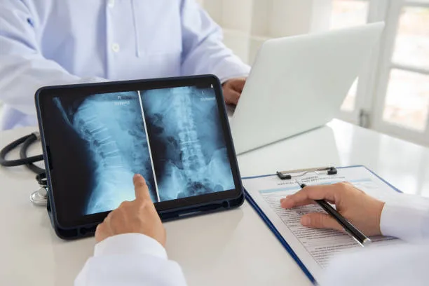 Se observa claramente en la radiografía un abultamiento discal que suele requerir tratamiento de hernia discal especializado