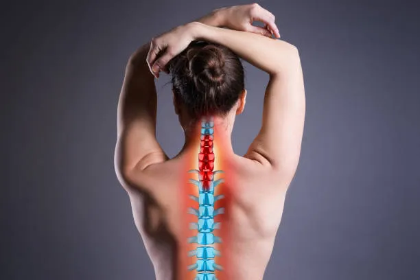 Mujer sujetando la zona baja del cuello con gesto de dolor asociado a hernia cervical, reflejando inflamación y molestia que afectan su movilidad y bienestar diario.