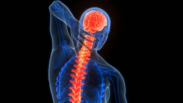 Radiografía mostrando la columna de un hombre con señales de desgaste y malestar asociado a lesiones columna, evidenciando posibles daños que requieren atención y tratamiento especializado.
