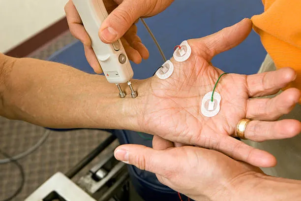 Mano de paciente conectada a dispositivo de electroterapia, con aplicación profesional para aliviar dolor y recuperar fuerza usando electroterapia