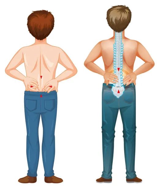 Imagen de dos hombres con dolor en la parte baja de la espalda, ilustrando los efectos de distintos tipos de lumbalgia sobre movimiento y postura